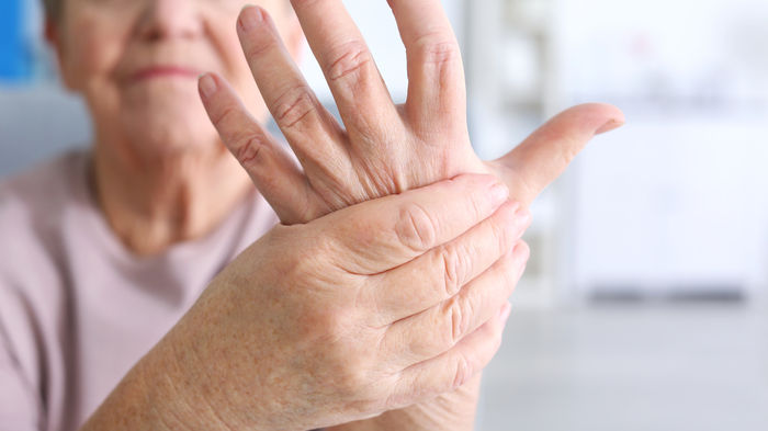 Treat to target – das zukunftsweisende Prinzip in der Behandlung der rheumatoiden Arthritis
