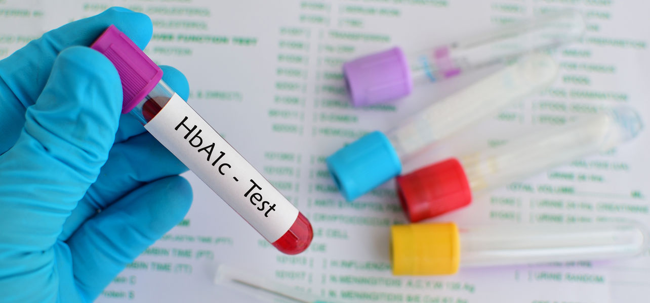 diabetes insulinresistenz therapie